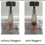 With and Without DNDS tube comparisons next to each other