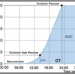 AUC Graph showing the occlusion pressure, occlusion start pressure, and base pressure