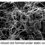 Static clot illustration with whole blood clot formed under static conditions text below it