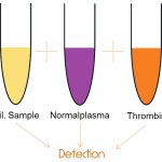 Dil. Sample, Normal Plasme, Thrombin equals Detection illustration