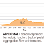 AUC-Abnormal Time & Pressure Graph on a transparent background