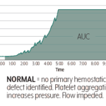 AUC-Abnormal Time & Pressure Graph on a transparent background