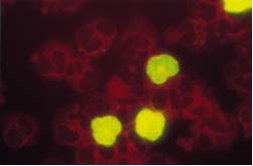 IQ CMV Brite Cytomegalovirus measurement assay kit