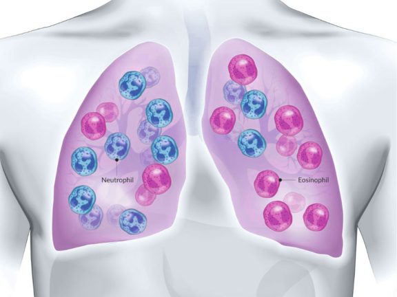 Fibrosis Product Category Featured Image