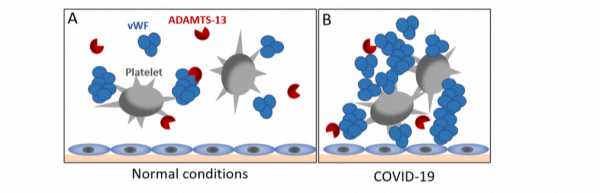Covid-19 ADAMTS-13