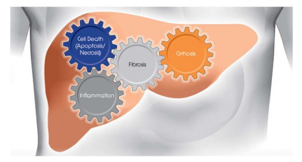 NASH Clinical Trials