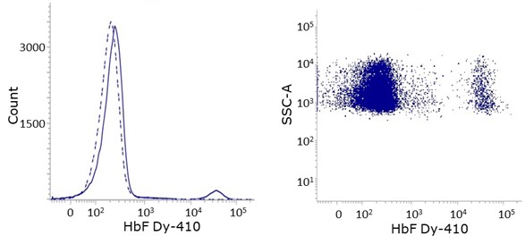 red blood cells stained with anti-HbF