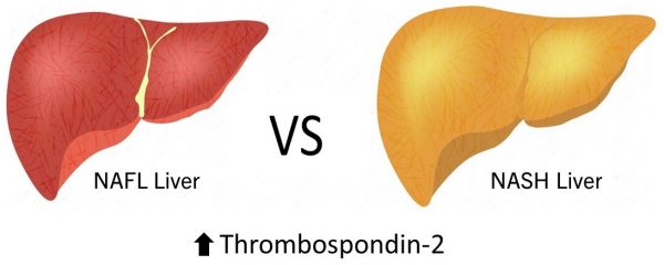 TSP2 NASH study