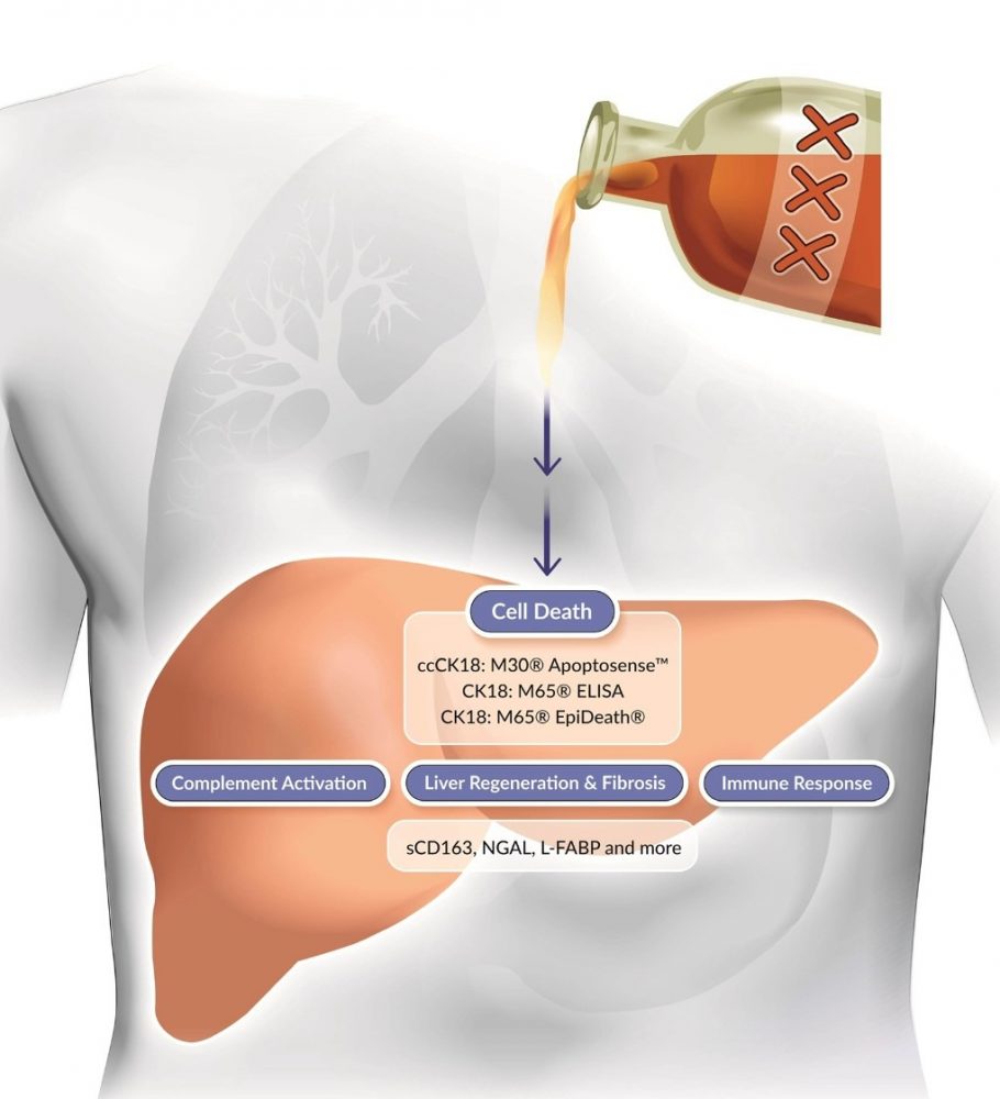 cell death, complement activation, liver regeneration fibrosis, immune response, ccCK18, M30 Apoptsosense, CK18, M65 EpiDeath, SCD163, NGAL, L-FABP